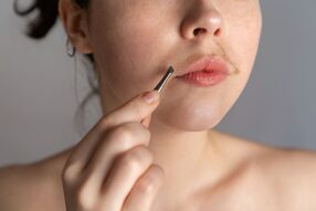 Electrolysis permanent hair removal for teens facial hair, teen tweezing hair on  upper lip