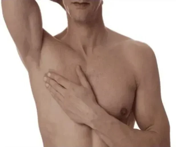 Underarm hair removal for men using electrolysis