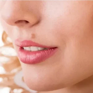 Close-up images of skin imperfections treated with electrocoagulation